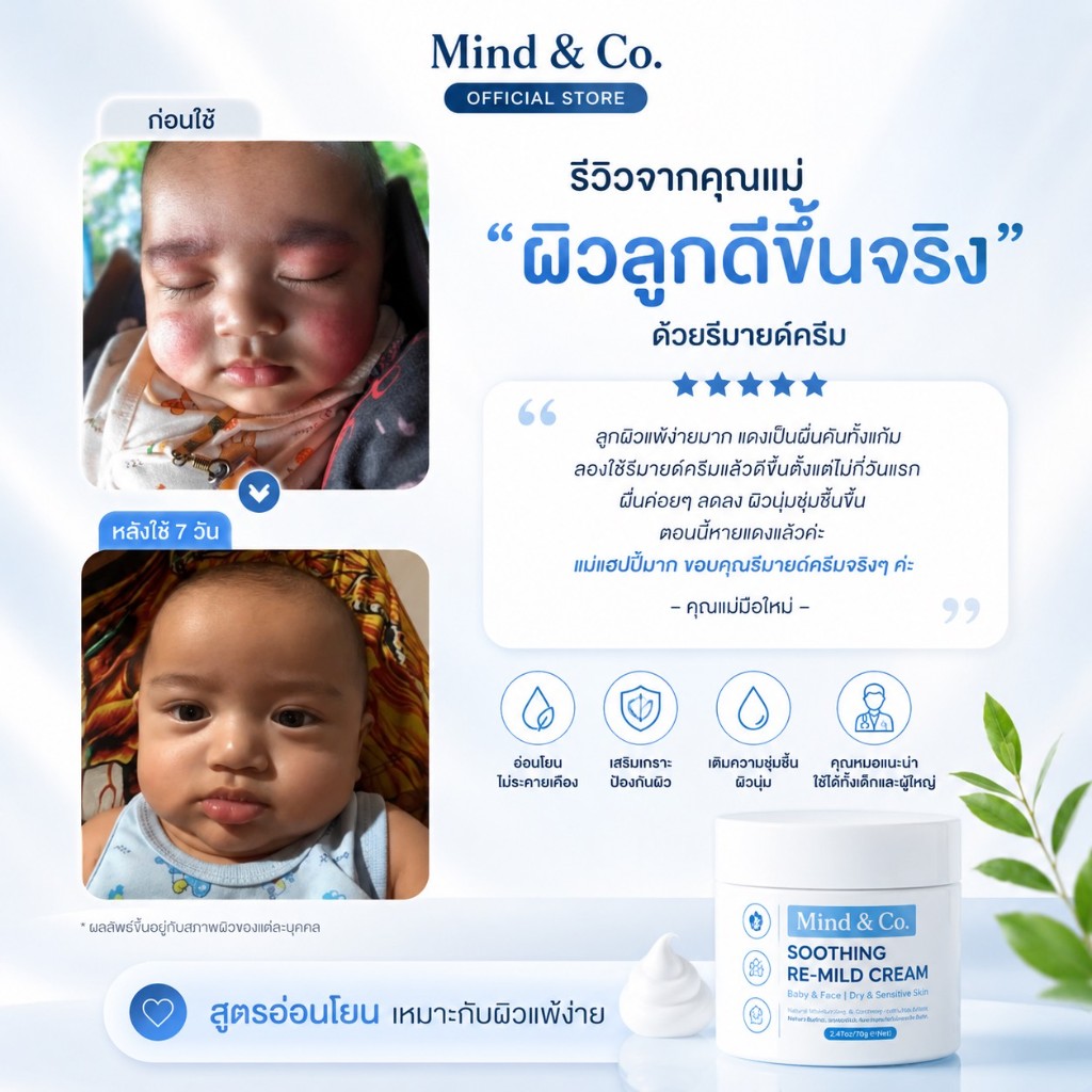 รีวิวจากคุณแม่ ลูกผิวดีขึ้นจริงด้วย Re-Mild Cream ก่อนและหลังใช้ 7 วัน